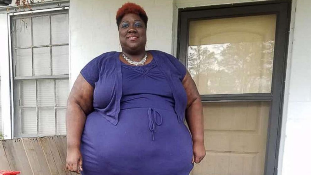 PHOTO: Leneathra Reed, 39, of Meridian, Mississippi, has kicked off her plan to lose 451 pounds.