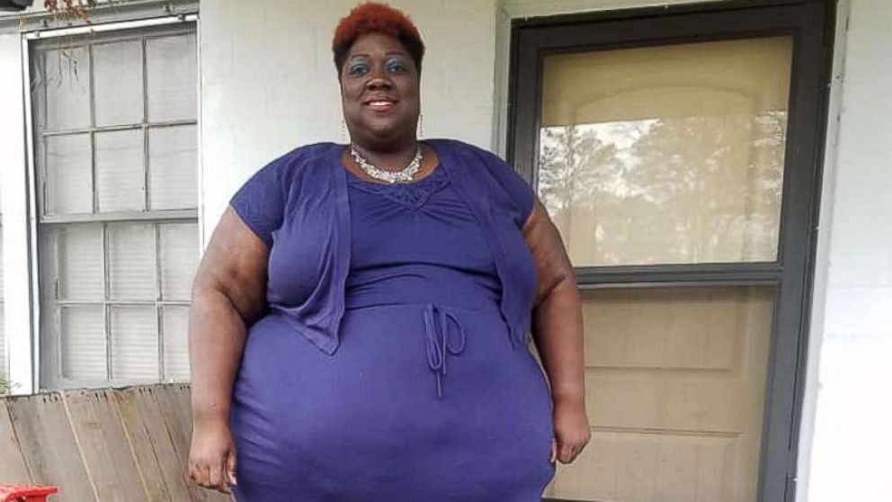 PHOTO: Leneathra Reed, 39, of Meridian, Mississippi, has kicked off her plan to lose 451 pounds.