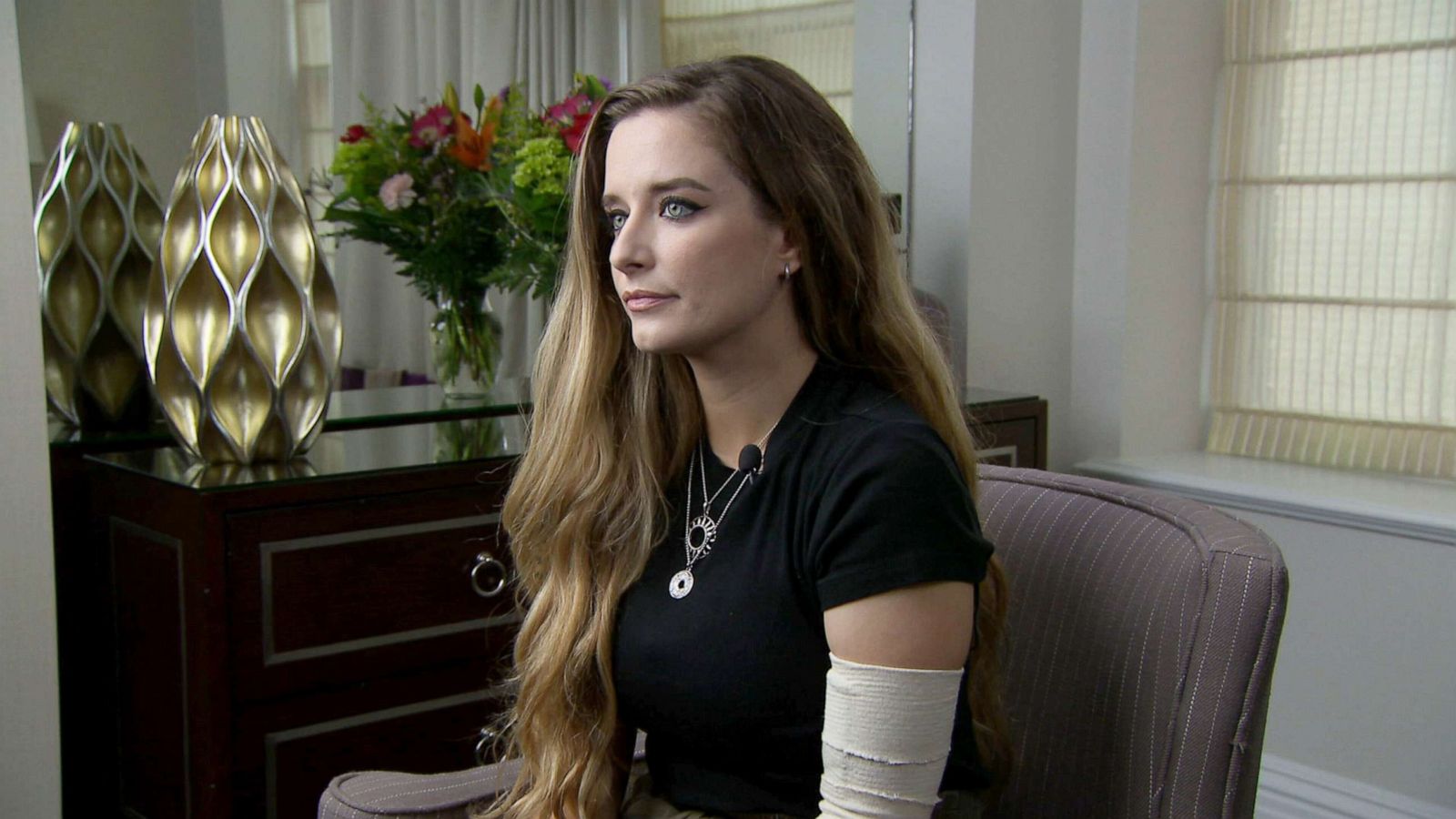 PHOTO: Amber Escudero-Kontostathis, survivor of the Aug. 4 lightning strike near the White House, is interviewed by Good Morning America, in Washington, Aug. 15, 2022.