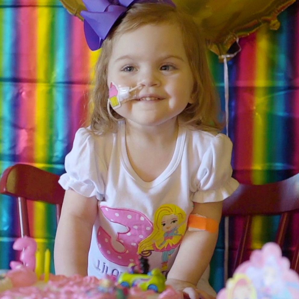 VIDEO: 3-year-old girl gets a life-saving birthday gift: a new liver and kidney