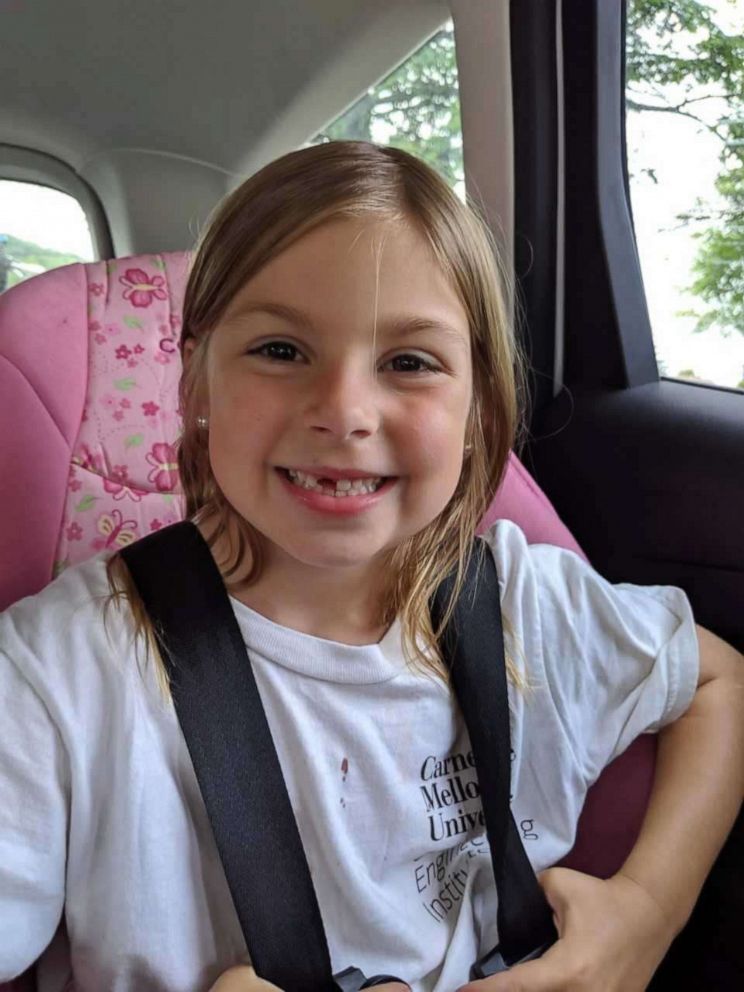 PHOTO: Lily Sciulli, 7, a first grade student at Burchfield Elementary School in Shaler Township, Pa., is shown on June 4, 2019, the day she lost her tooth.