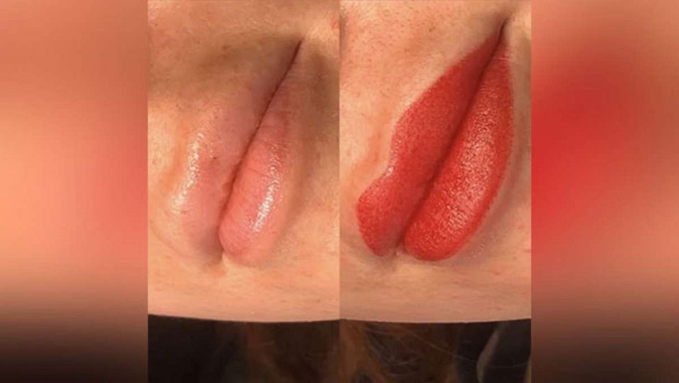 PHOTO: Tess Hendersen's lips before lip blushing (pictured left) and after the procedure (pictured right). 