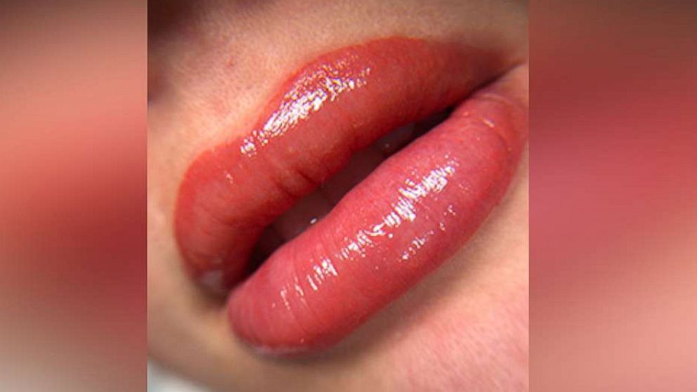 PHOTO: Lip blush, also known as lip blushing, is a hot new trend that is sweeping across the nation.