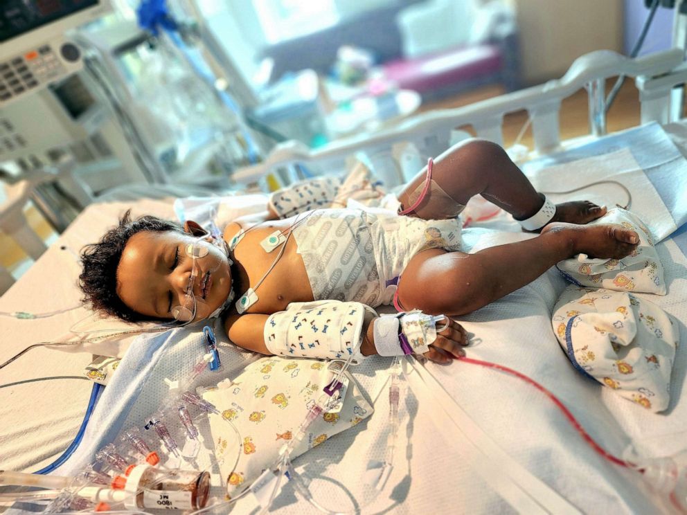 PHOTO: Logan Salva, a toddler from Florida, is pictured while recovering from a partial liver transplant.