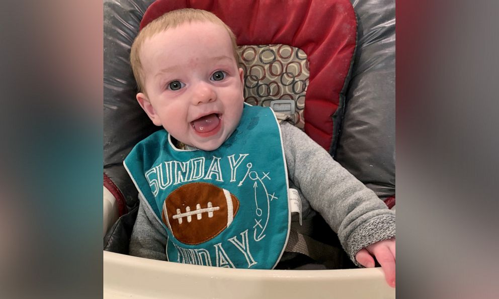 PHOTO: Sara Ward, a mom from St. Louis, Missouri, is sharing her story after her 5-month-old son developed hair tourniquet syndrome in January and had to be rushed to the ER.