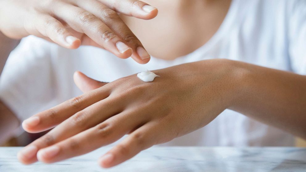 PHOTO: Stock photo of a woman applying lotion.