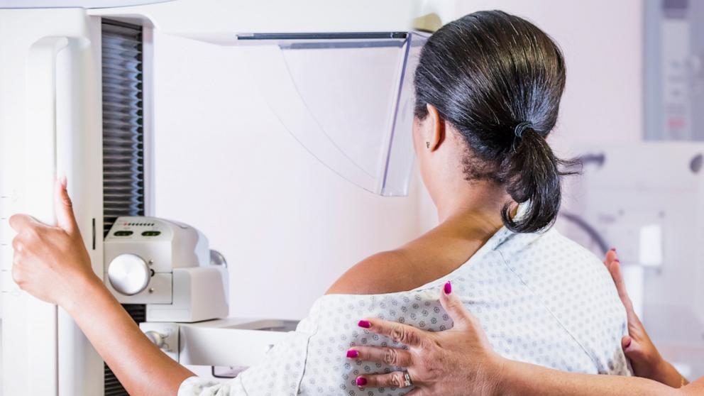 PHOTO: In this undated stock photo, a woman is seen gettin a mammogram. 