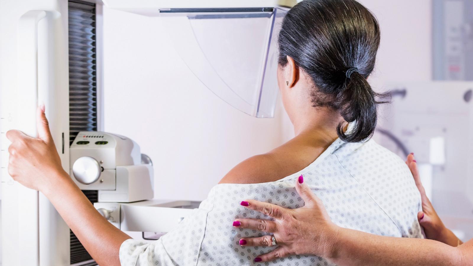 PHOTO: In this undated stock photo, a woman is seen gettin a mammogram.