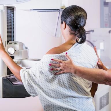 PHOTO: In this undated stock photo, a woman is seen gettin a mammogram. 
