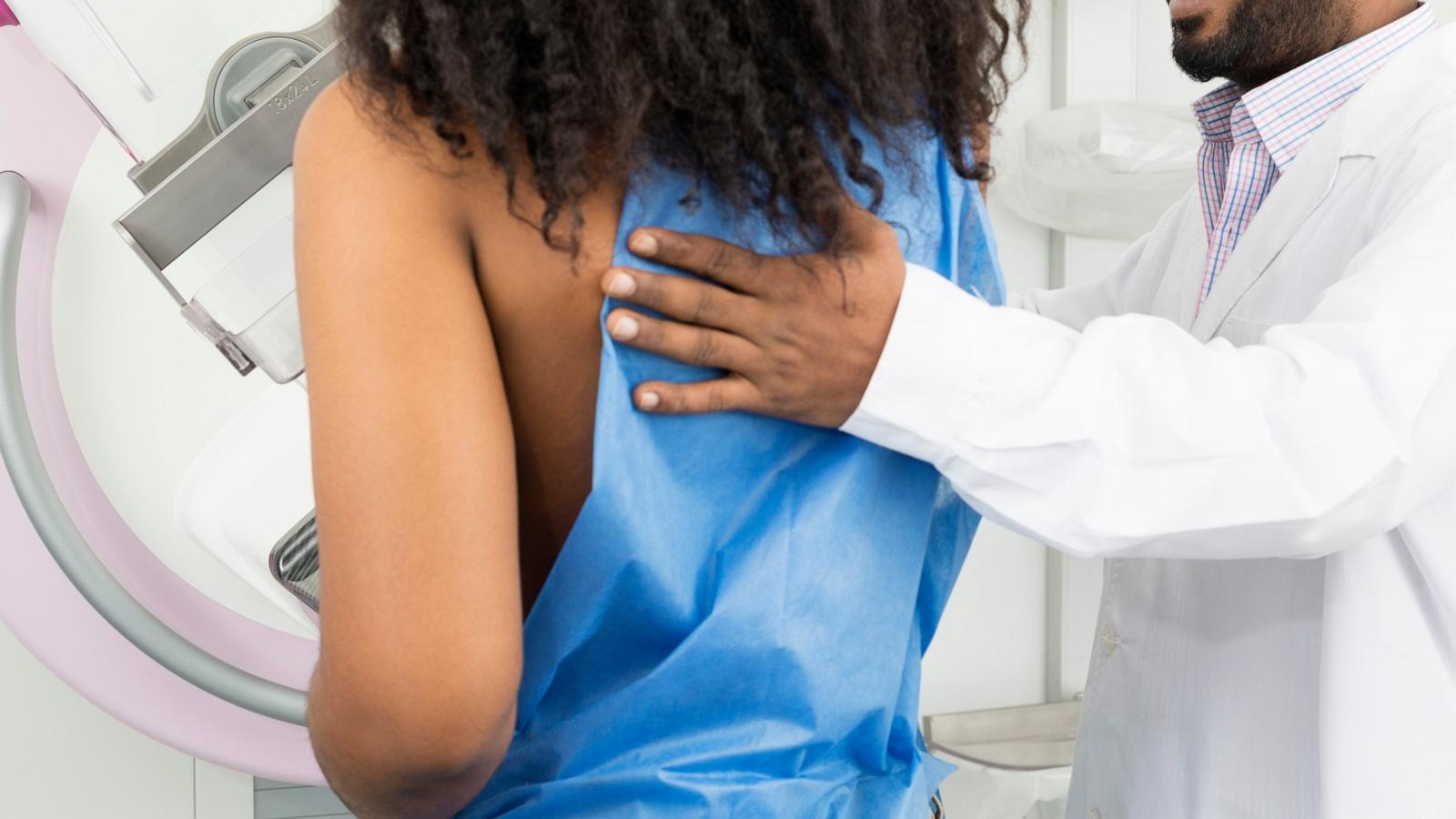 PHOTO: Woman Undergoing Mammogram Test in an undated stock photo.