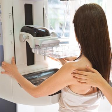 PHOTO: In this undated stock photo, a doctor performs a mammogram on a patient.