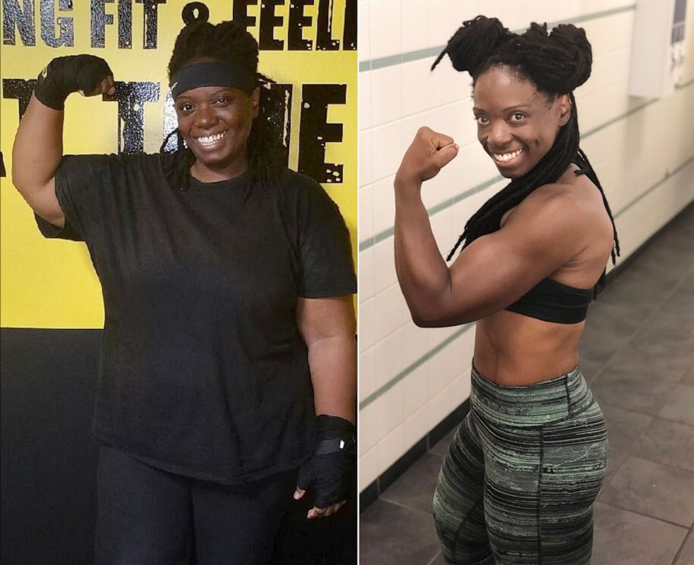 PHOTO: Marsha Parker, 41, of New York City, lost 155 pounds.