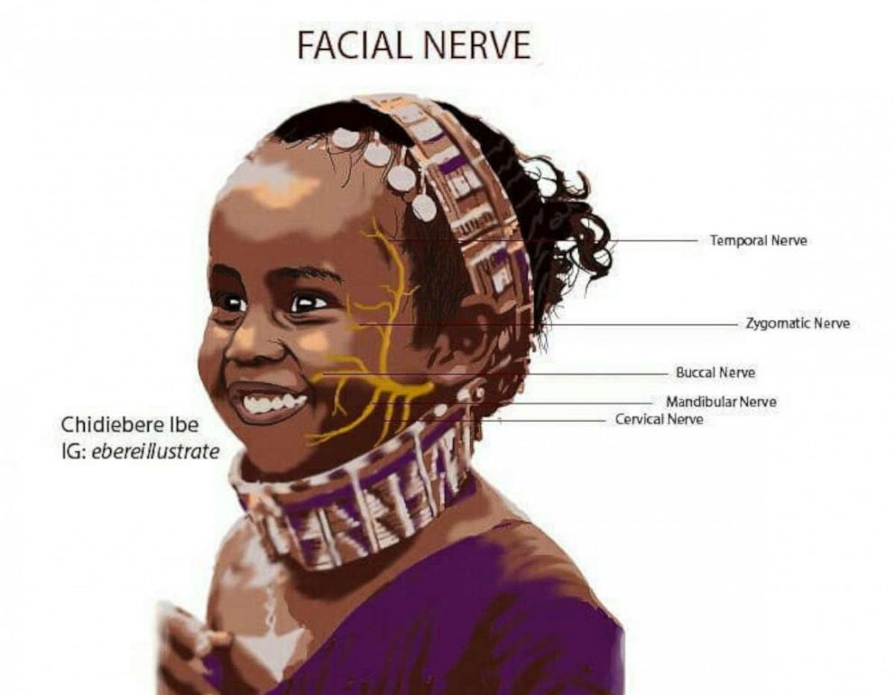 PHOTO: Medical illustration showing facial nerves on a child.