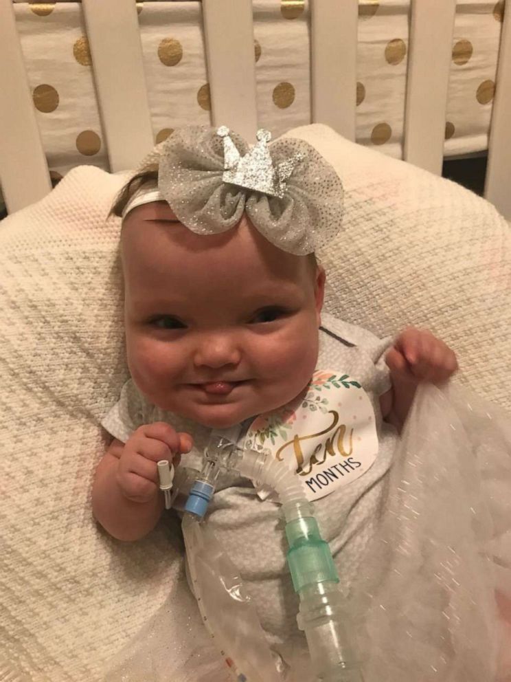 PHOTO: Joy Day, now 10 months old, spent 268 days in a Missouri hospital NICU. The children is now home iwth her parnets, Amber and JP Day, of Columbia, Missouri, and her three siblings.