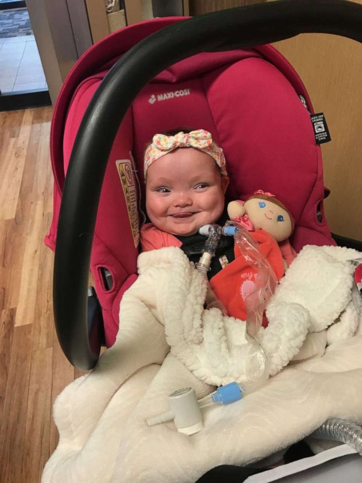 PHOTO: Joy Day is seen on Oct. 28, the day she was discharged from the NICU at MU Women's and Children's Hospital in Columbia, Missouri.