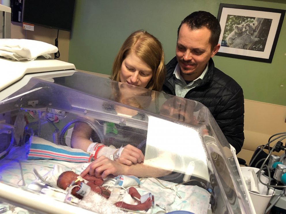 PHOTO: Joy Day was born Feb. 2, weighing 2 pounds, 1 ounce, at MU Women's and Children's Hospital in Columbia, Missouri. She was released on Oct. 28 from the NICU.