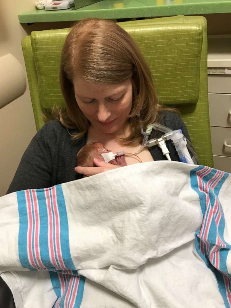 PHOTO: Joy Day was born Feb. 2, weighing 2 pounds, 1 ounce, at MU Women's and Children's Hospital in Columbia, Missouri. Ten days later, her mother Amber, holds her for skin-to-skin contact.