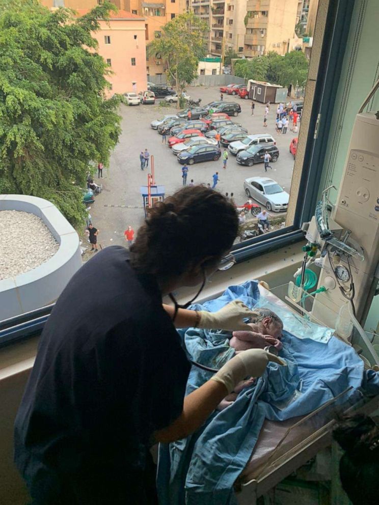 PHOTO: George Khnaisser came into the world on Aug. 4, one hour after the explosion in Beirut, Lebanon. Here, a medical staff member treats baby George at Saint George Hospital University Medical Center in Beirut.