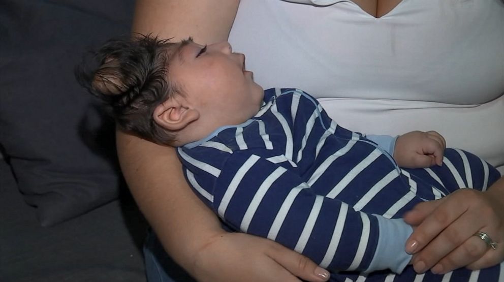 PHOTO: Lucas Santa Maria is the only baby in the world who has survived a fatal condition called exencephaly.