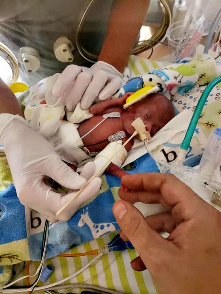 FOTO: Richard Hutchinson está en casa para las vacaciones después de pasar seis meses luchando por su vida en el hospital Children's Minnesota de Minneapolis.