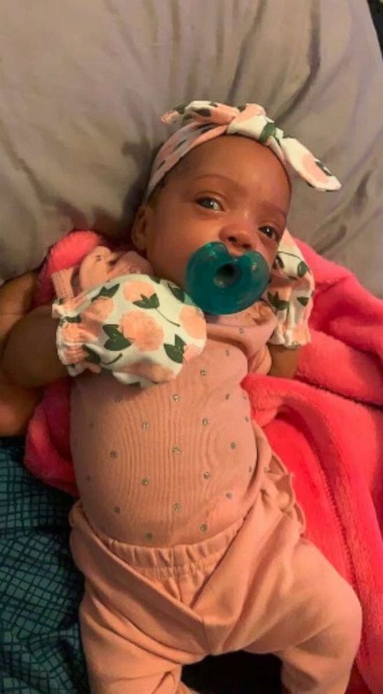 PHOTO: On Sept. 23, Monique Jones of Ferguson, Missouri, welcomed Zamyrah Prewitt who arrived at 29 weeks gestation weighing 2 pounds, 5 ounces. 