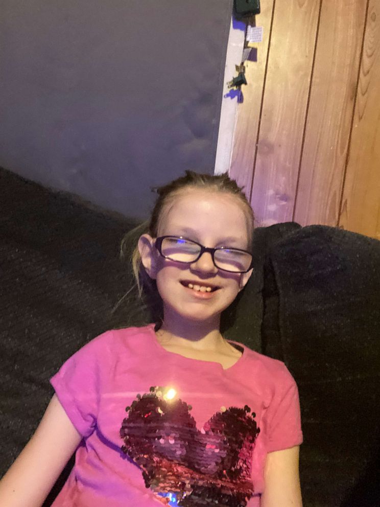 PHOTO: Marfan syndrome is a connective tissue disorder that affects 1 in 5,000 people. Seen in this undated photo is Maryssa Wilson, 8, of Norwich, Connecticut, who has Marfan syndrome or another connective tissue disorder based on physical traits.