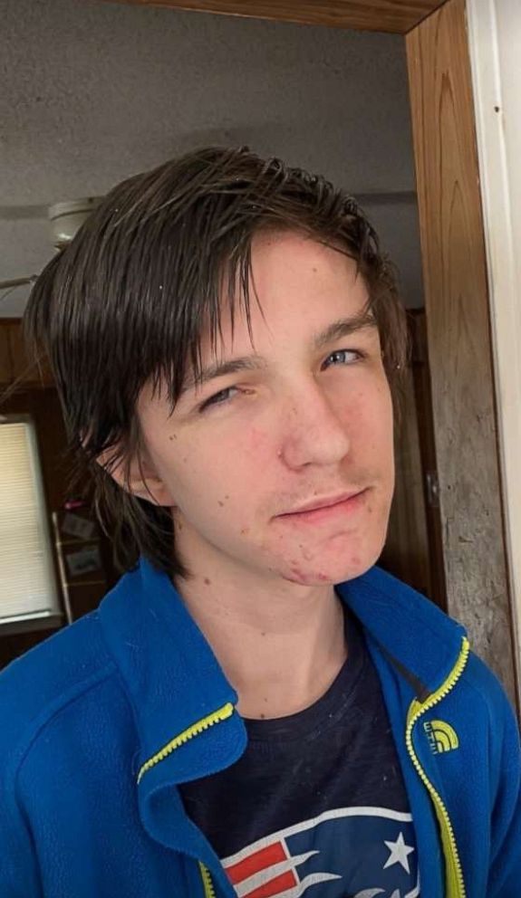 PHOTO: About 3 out of 4 people with Marfan syndrome inherit it, meaning they get the genetic mutation from a parent who has it. Seen in this undated photo is 14-year-old Brady Wilson of Norwich, Connecticut, who is undergoing testing for Marfan.