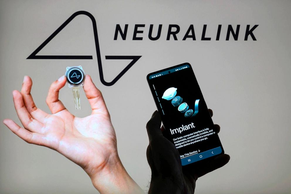 PHOTO: The Neuralink web site is displayed on a smartphone with Neuralink logo visible in the background in this photo illustration, on May 13, 2024, in Brussels, Belgium.