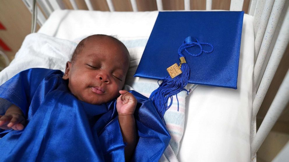 PHOTO: Baby Alanie, who was born at 23 weeks, graduated from the neonatal intensive care unit at Broward Health Medical Center in Fort Lauderdale, Florida, in May and is now home with his family in the U.S. Virgin Islands.