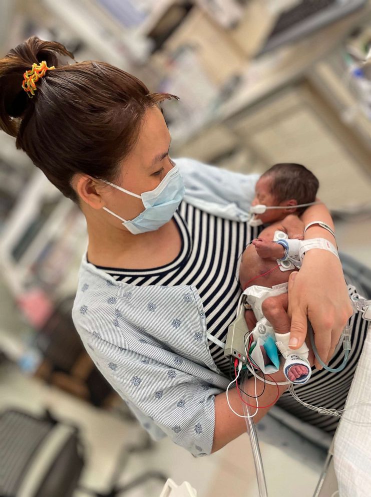 PHOTO: Max Do is pictured in a undated photo from during his hospital stay in Illinois. Max was discharged from the hospital on May 23 after 11 months in the NICU.
