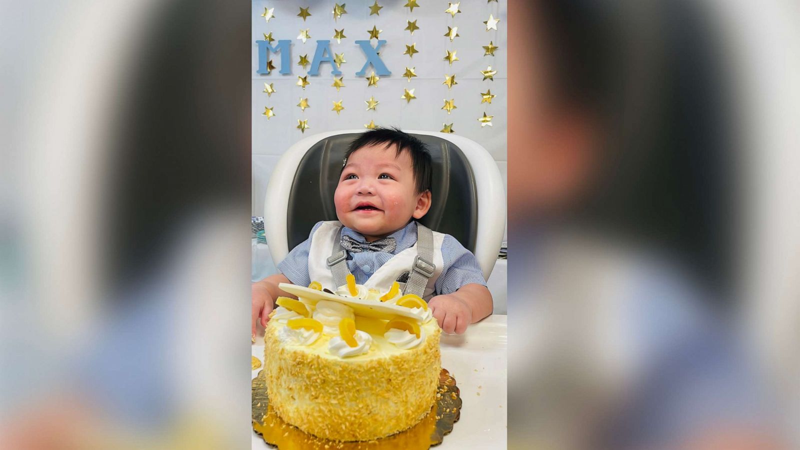 PHOTO: Max Do will turn one year old on June 4, 2022. Max who has the only known case of a rare condition was discharged from the hospital after 11 months in Park Ridge, Il.