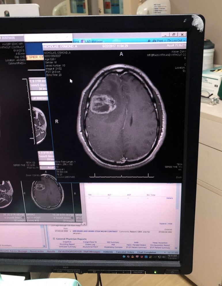 PHOTO: A scan of Nicholas' brain, taken in June 2017, displayed a tumor that required emergency surgery.