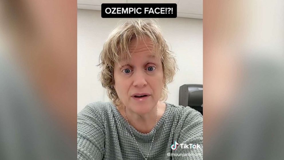 PHOTO: TikTok user @mounjaromom took to the platform to share her thoughts on "Ozempic face."