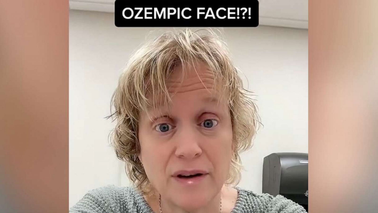 PHOTO: TikTok user @mounjaromom took to the platform to share her thoughts on "Ozempic face."