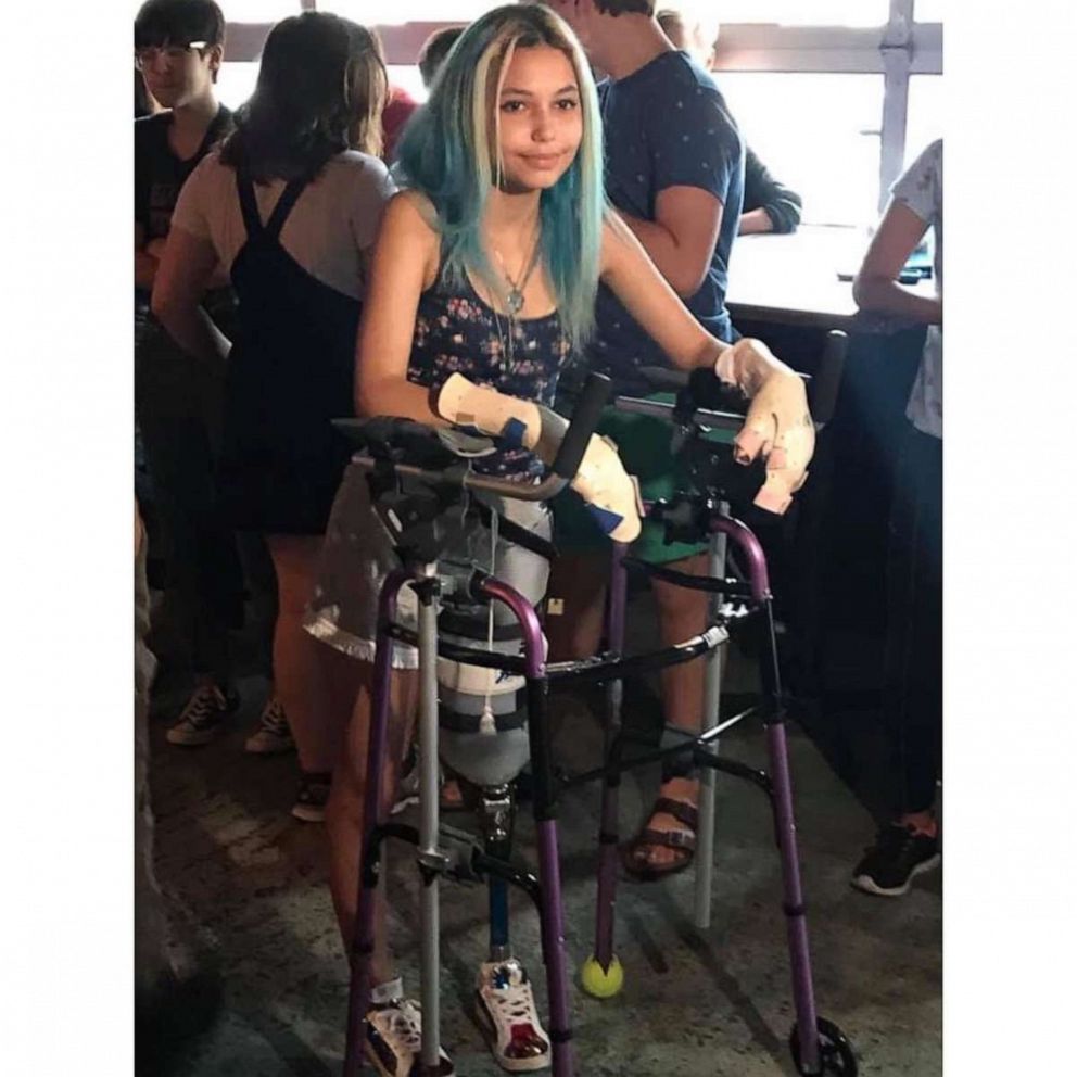 PHOTO: Paige Winter stands using a walker after she recovered from a shark attack in 2019.