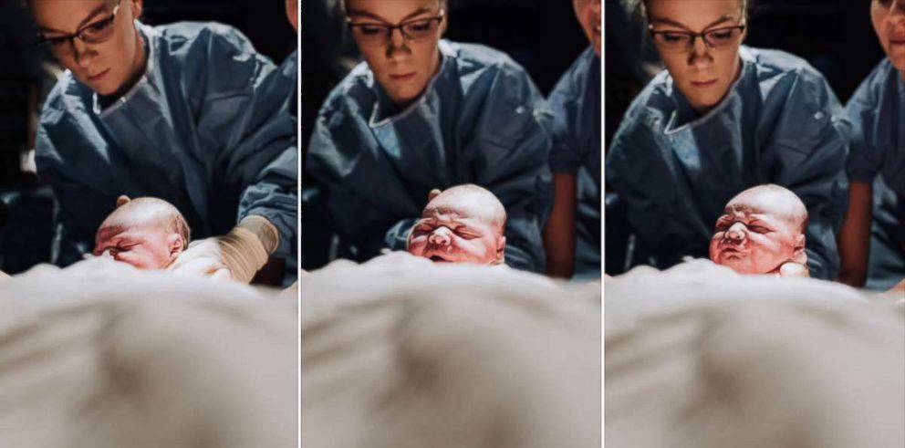 PHOTO: While in labor, Megan Mattiuzzo photographed the birth of her own son.