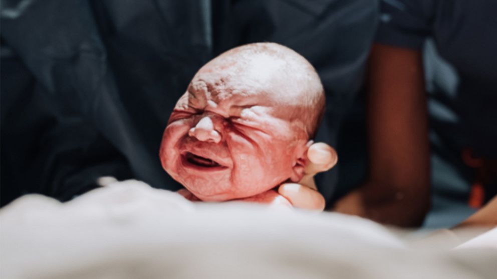 Mom photographs birth of her own son in live birth photos - ABC News