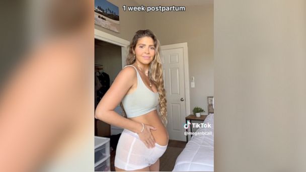 Mom of 3 gets real about her postpartum body - Good Morning America