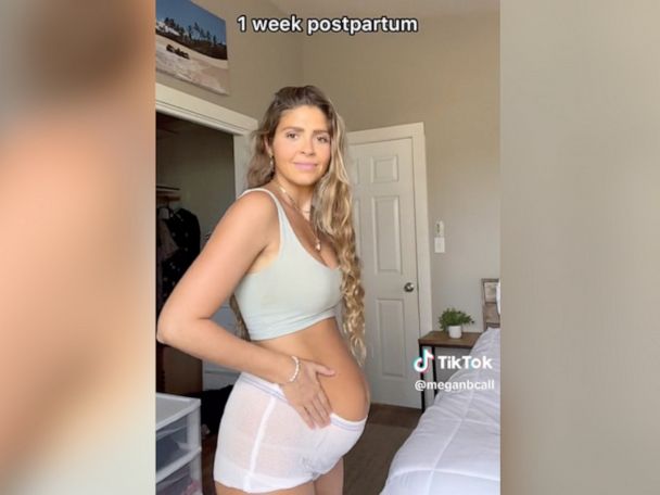 Mom Shares Side-by-Side Postpartum Photos