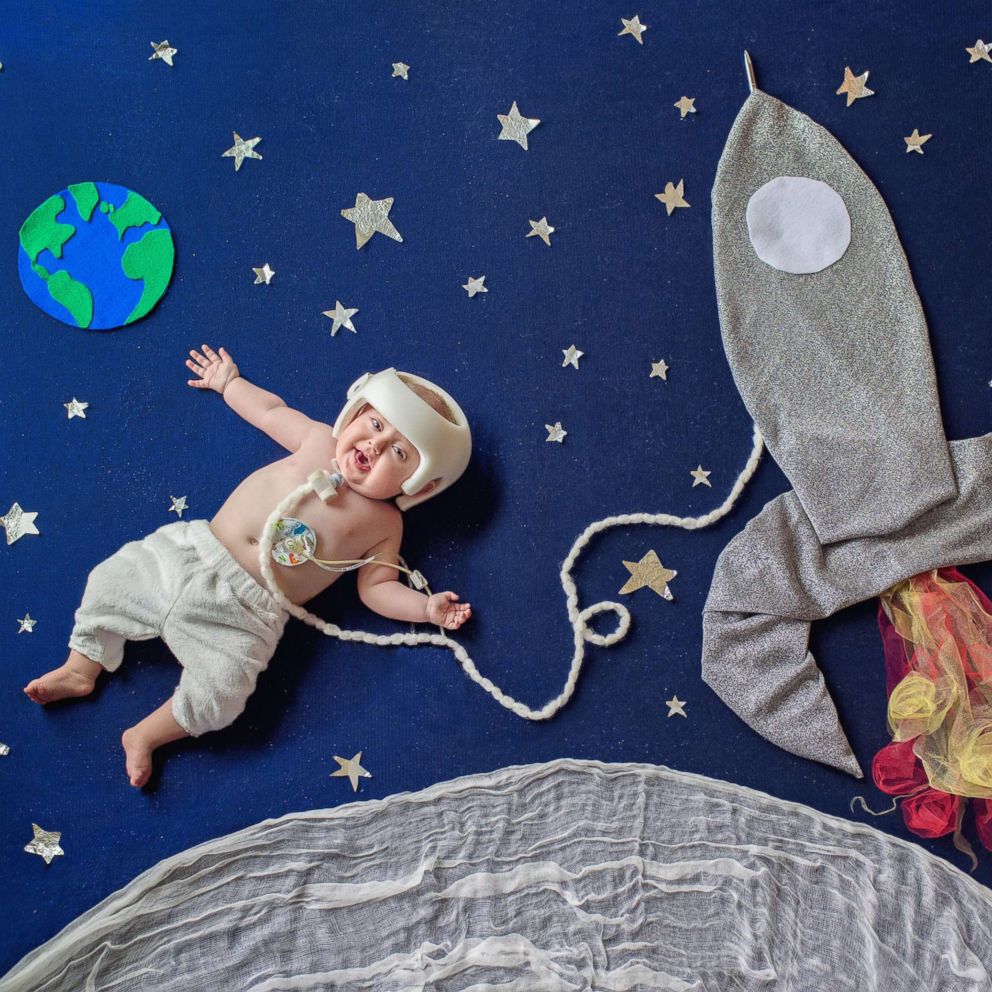 VIDEO: These imaginative photos help differently abled babies defy the impossible