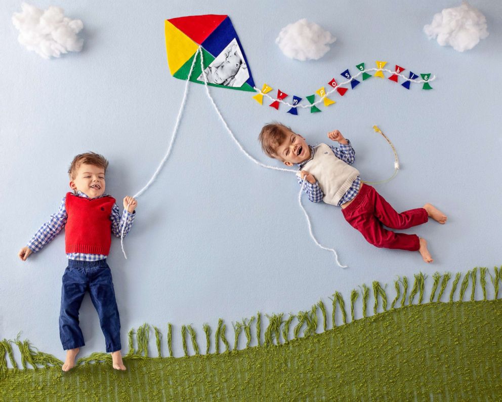 PHOTO: Conjoined twins are connect through strings on a kite.