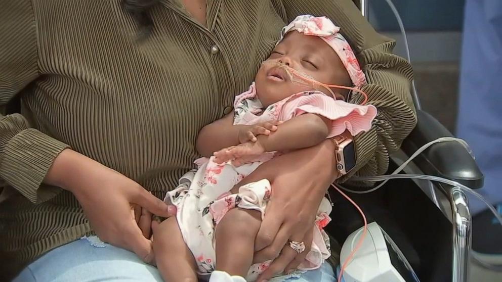 PHOTO: Nyla Brooke Haywood was born at 22 weeks at Silver Cross Hospital in Illinois.