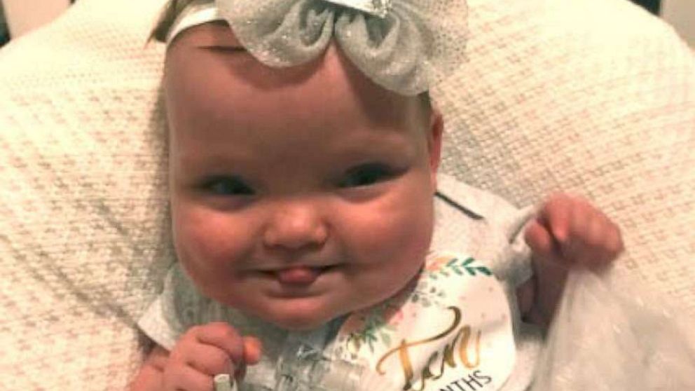 PHOTO: Joy Day was born Feb. 2, weighing 2 pounds, 1 ounce, at MU Women's and Children's Hospital in Columbia, Missouri, She was released on Oct. 28