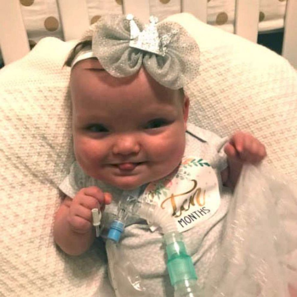VIDEO: Micro preemie is home for Christmas after 268 days in NICU 