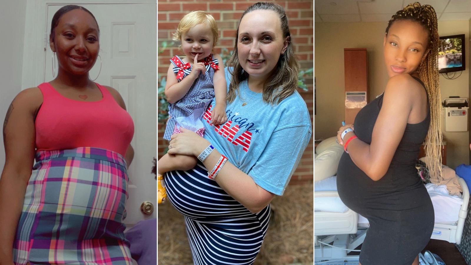 PHOTO: Keaira Davis, left, Summer Morrison, center, and Vakoya Miller each carried monoamniotic twin pregnancies.