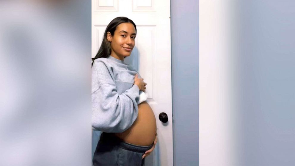 PHOTO: Raquel Rodriguez, of Minnesota, is pictured one day after having a 10-pound cyst removed from her stomach.