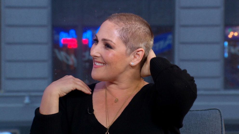 PHOTO: Former talk show host Ricki Lake tells "Good Morning America," on Jan. 3, 2020, she has been struggling with hair loss for nearly 30 years.