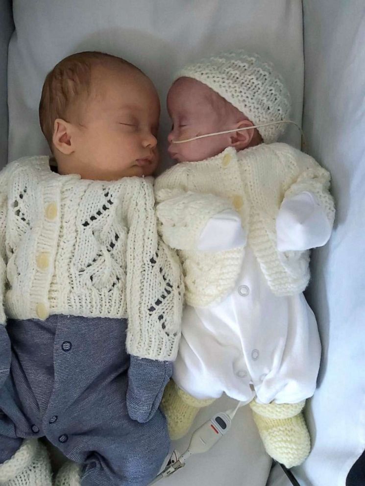 PHOTO: Twins Noah and Rosalie were born on the same day but were conceived at different points.