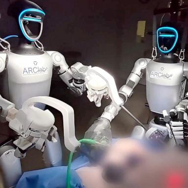 PHOTO: Humanoid robots, guided by surgeons, performed two operations at the University of California San Diego for the first time.