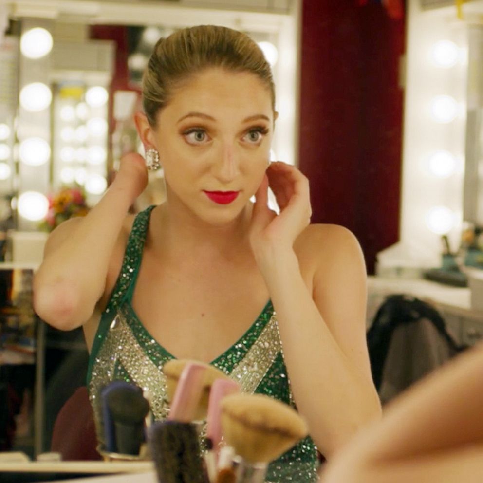 VIDEO: How one woman born without a left hand became a Rockette 